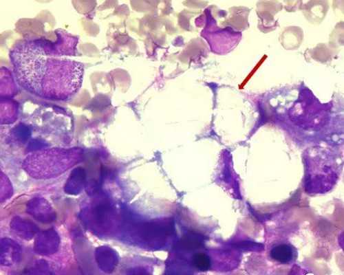 武汉代孕公司在哪,武汉供卵试管费用,武汉试管婴儿捐卵供卵