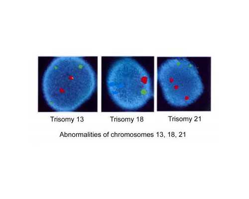 武汉宛如试管,武汉三代试管婴儿**男孩价格表一览